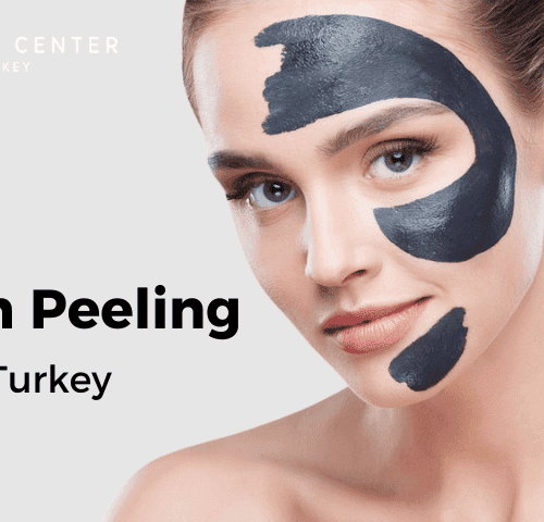 Carbon Peeling In Turkey