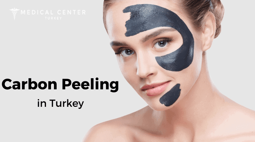 Carbon Peeling In Turkey (1) Carbon Peeling In Turkey