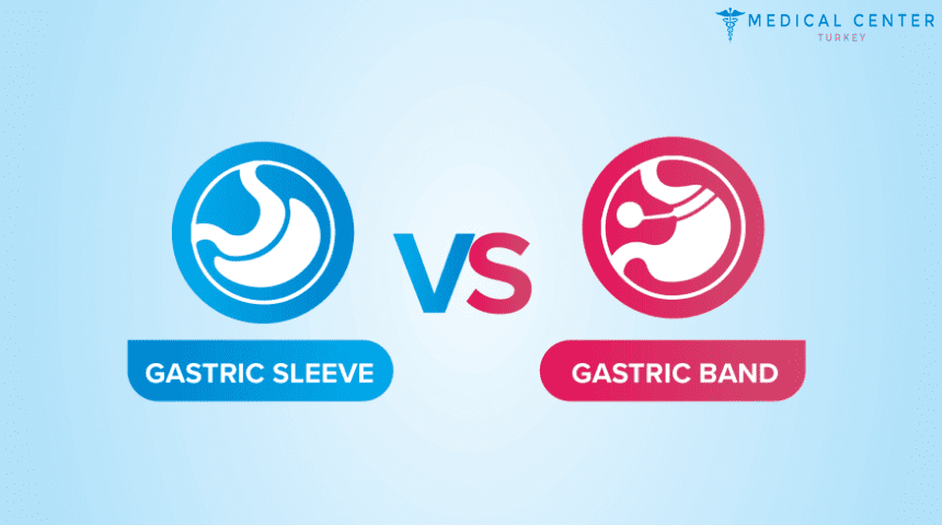 Gastric Band vs Gastric Sleeve Gastric Band vs Gastric Sleeve