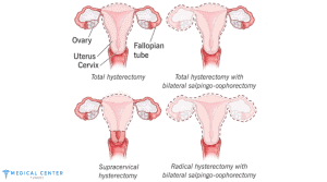 Hysterectomy in Turkey