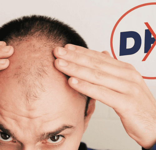 Everything You Need to Know About DHT Blockers Everything You Need to Know About DHT Blockers