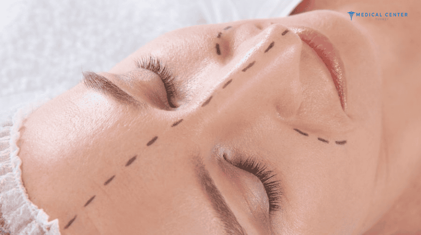 The 5 Best Countries for Rhinoplasty Surgery The 5 Best Countries for Rhinoplasty Surgery
