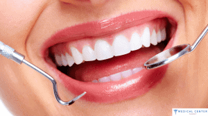 What Is Restorative Dentistry?
