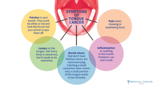 Tongue Cancer