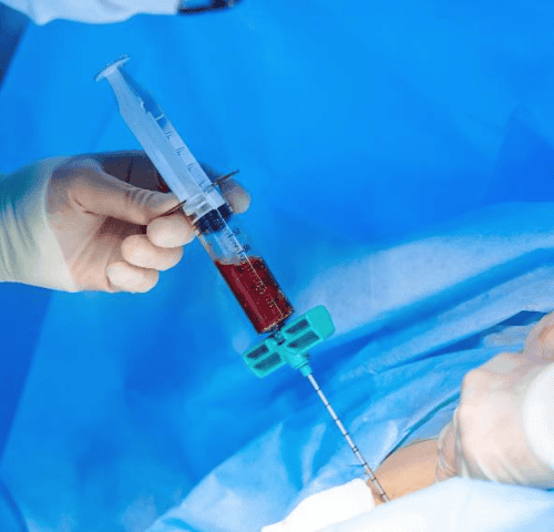 Bone Marrow Transplantation in Turkey