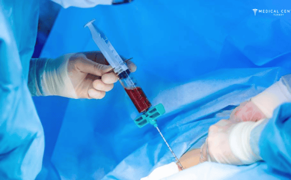 Bone Marrow Transplantation in Turkey