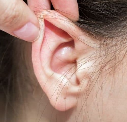 Ear Correction Surgery Cost in Turkey