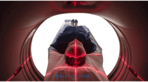 Radiotheraphy For Throat Cancer 