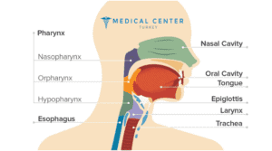 Throat Cancer 4