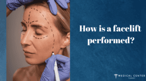 Facelift Healing Time