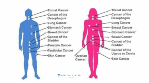 Which Cancer Types are Deadly (3)