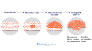 Which Cancer Types are Deadly (6)