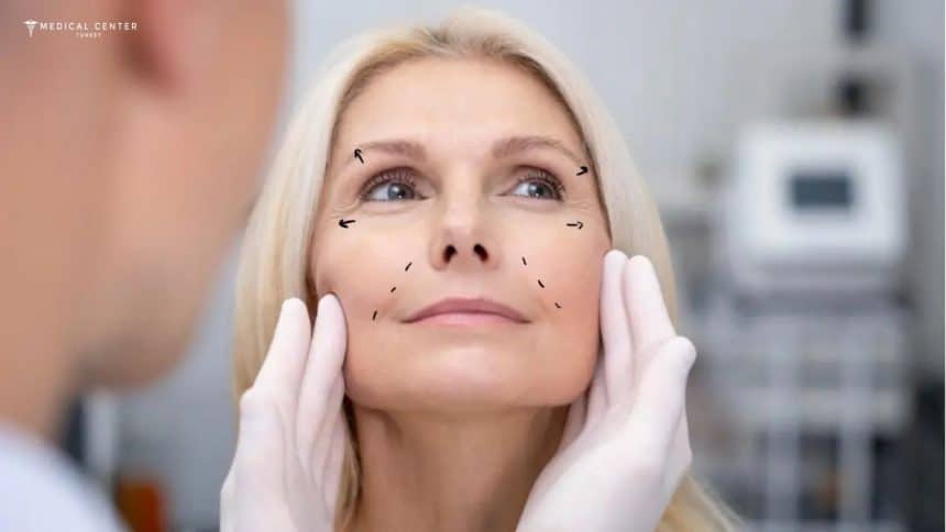 Facelift Healing Time Facelift Healing Time