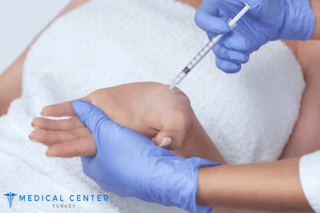 Botox For Armpit Sweat