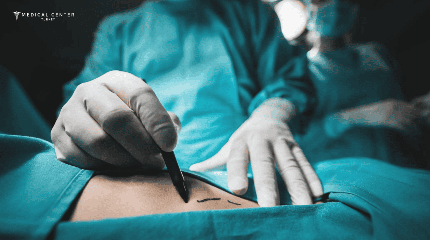 The Best Hospital for Liposuction in Turkey The Best Hospital for Liposuction in Turkey