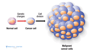early cancer detection in turkey 