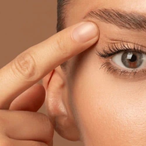 Fox Eyes Surgery in Turkey Fox Eyes Surgery in Turkey
