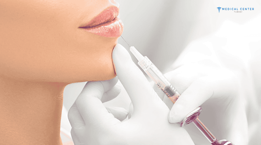 The Lip Filler Cost in Turkey 2025 The Lip Filler Cost in Turkey 2025