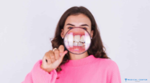Black Teeth Causes Treatments in Turkey 1