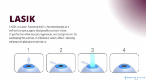LASIK in Turkey