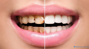 What is Restorative Dentistry?