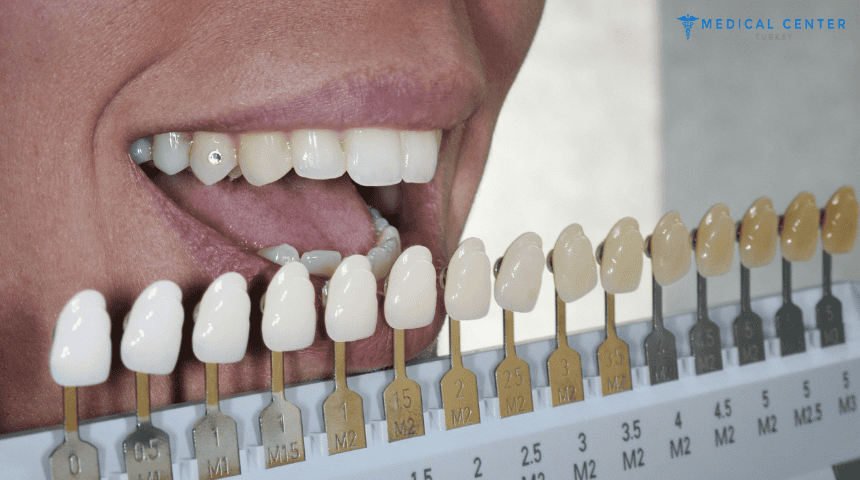 Effective Treatments for Tooth Discoloration in Turkey