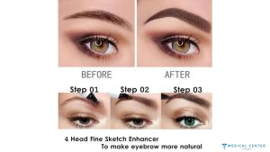 The Benefits of Microblading for Eyebrow Enhancement in Turkey
