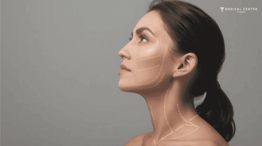 Expectations of Neck Lift Surgery in Turkey Expectations of Neck Lift Surgery in Turkey