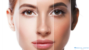 Microblading in Turkey: Types, Prices, Procedures