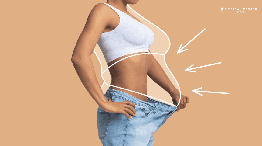 Medical Tourism: Weight Loss Surgery Abroad? Medical Tourism: Weight Loss Surgery Abroad?