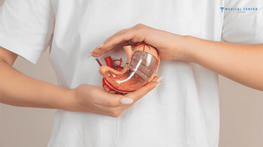 Advantages of a Gastric Bypass in Turkey 2025 Advantages of a Gastric Bypass in Turkey 2025