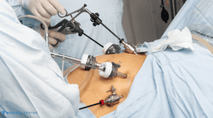 Are You Eligible for Gastric Bypass Surgery?