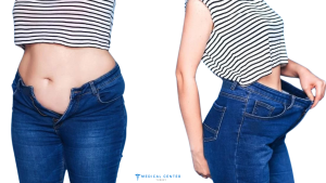 Laser Lipo vs. Vaser Lipo: Which is Better for 2025?