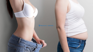 Medical Tourism: Weight Loss Surgery Abroad?