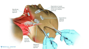 What to Expect After the Neck Lift Surgery in Turkey?