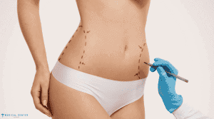 What Are the Risks Involved in Liposuction?