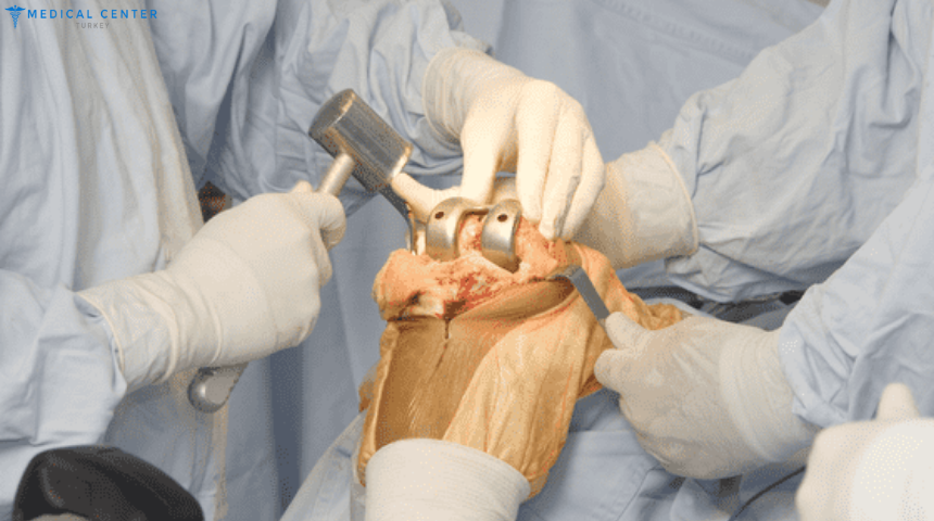 Are Orthopedic Surgeries Safer and More Affordable in 2025?