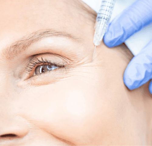 Is Botox Worth it in 2025? Is Botox Worth it in 2025?