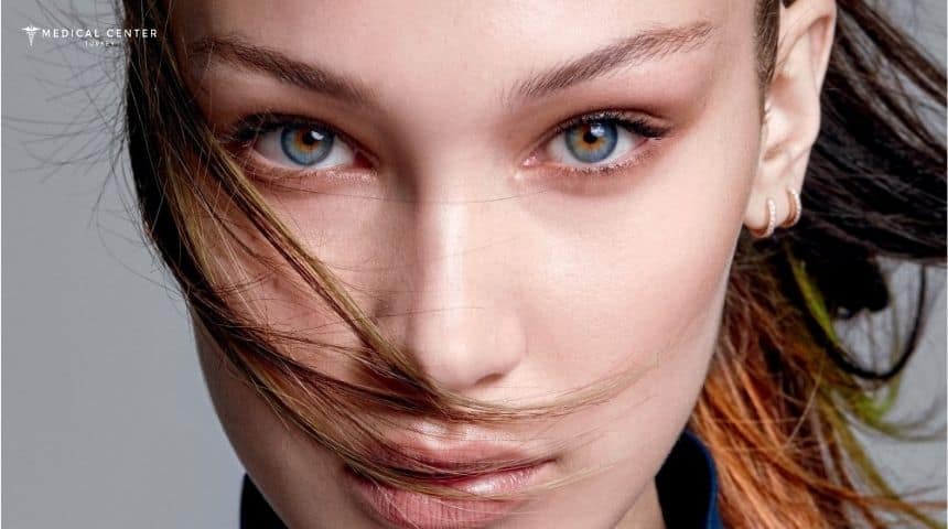 Bella Eyes Surgery in Turkey Bella Eyes Surgery in Turkey