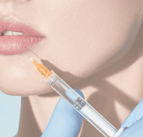Do Lip Fillers Still Look Natural in 2026? Do Lip Fillers Still Look Natural in 2026?