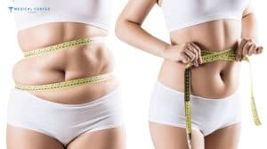 What is New in HD Liposuction for 2026?
