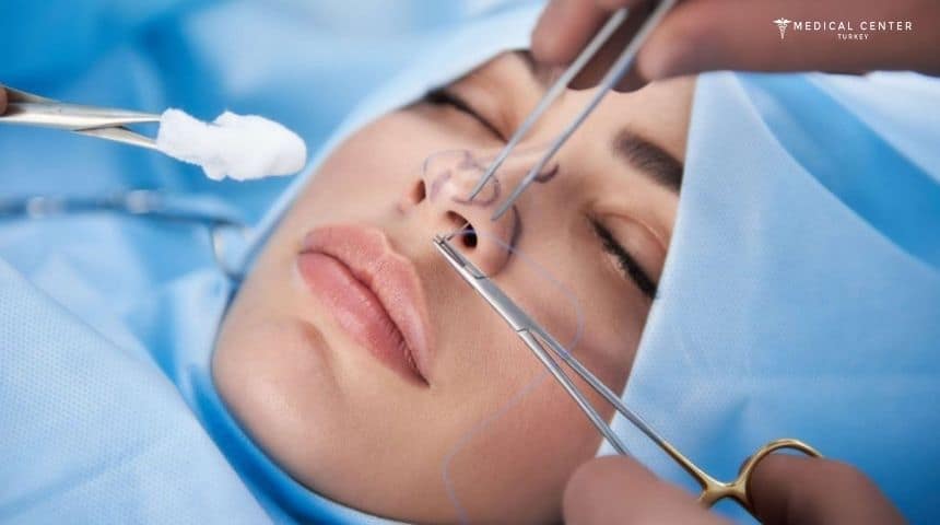 Which Is Better Open or Closed Rhinoplasty?
