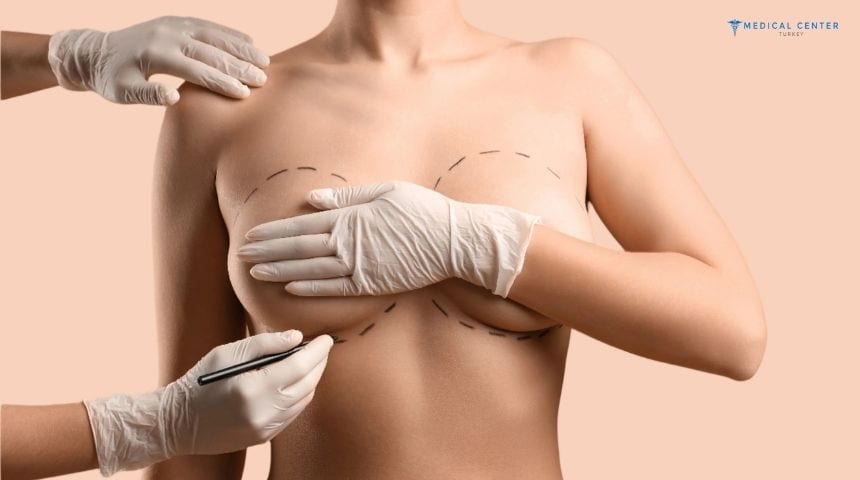 All Options For Breast Augmentation