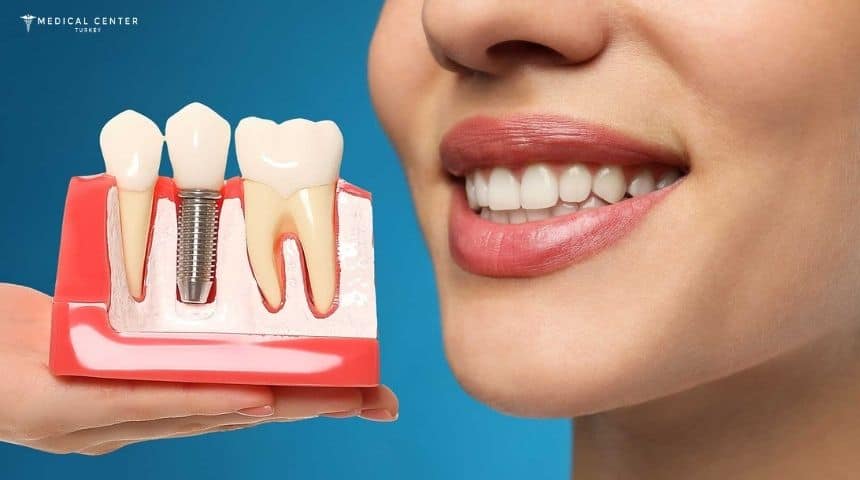 Which Dental Implant Option Is Best for You? Which Dental Implant Option Is Best for You?
