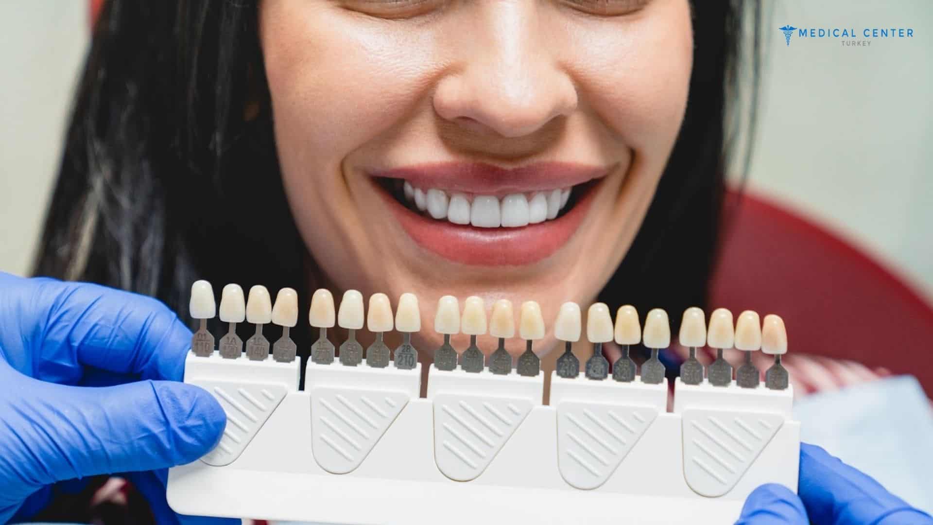 Differences Between Dental Implants and Veneers