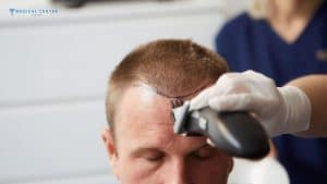 Hair Transplant Recovery Process and Care Tips