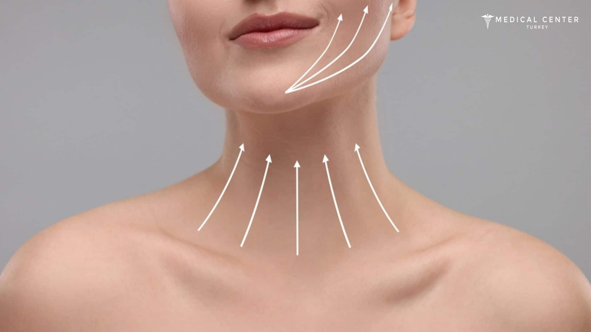 Achieving a Rejuvenation with Neck Lift Surgery
