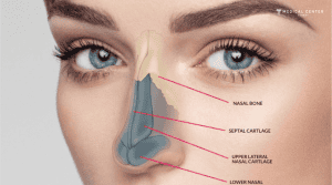Harris’s Rhinoplasty Experiences in Turkey