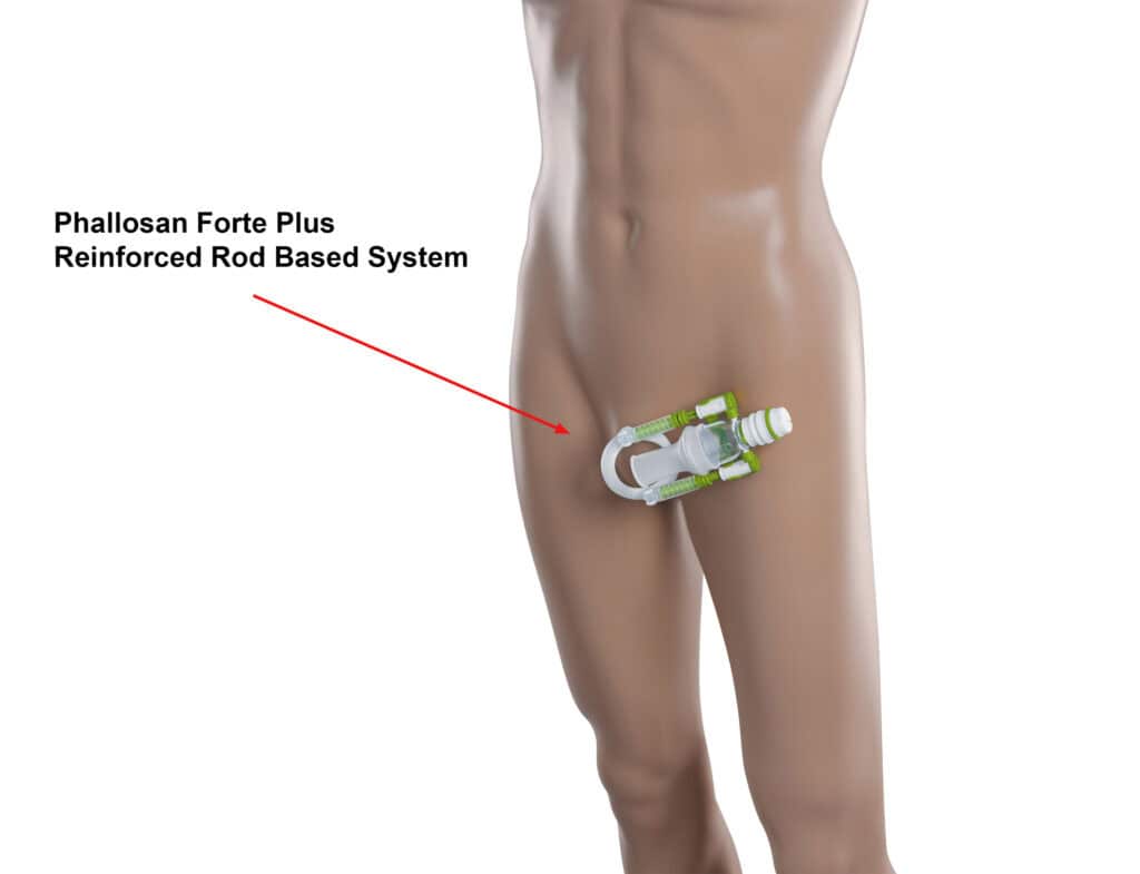 Phallo Review Dummy