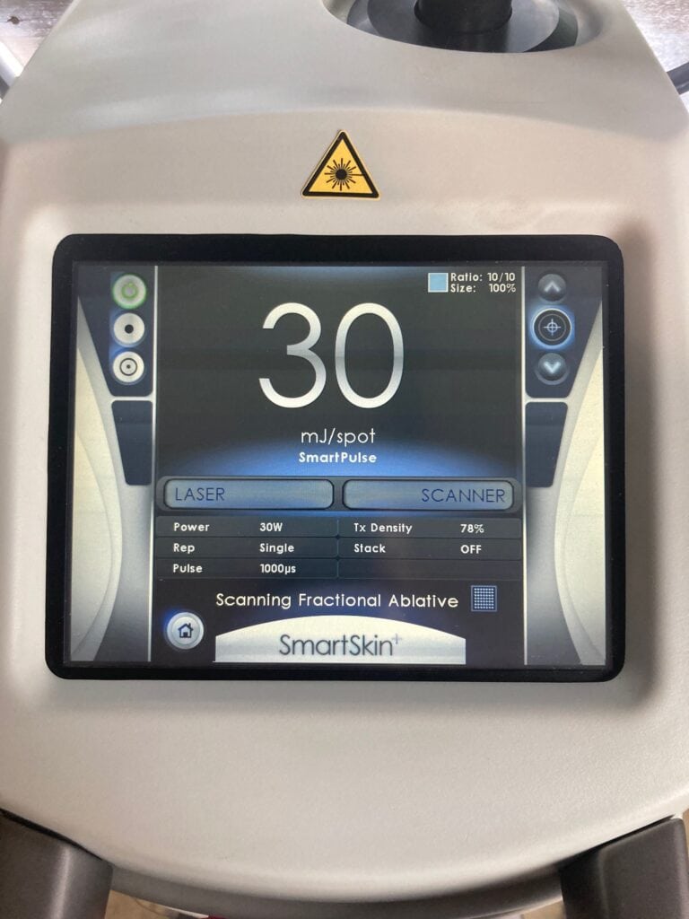 2015 Cynosure Smart Skin Certified refurbished Laser machine | The Laser Agent